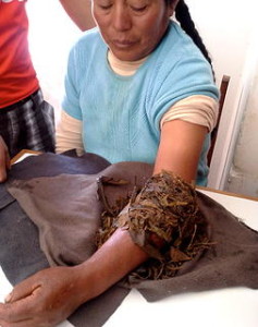Andean Medicine
